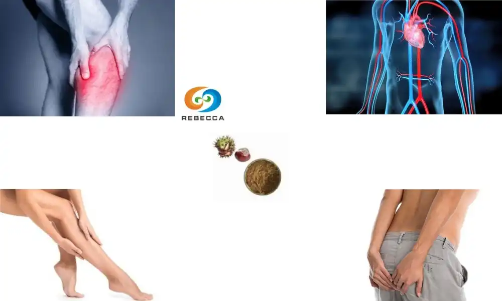Horse Chestnut Seed Extract Powder and Its Effects on Swelling and Inflammation